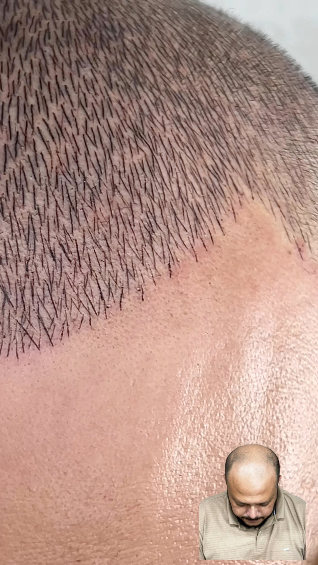 Detailansicht — Einblicke in die Behandlungstechnik